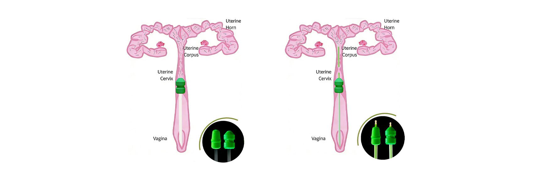 Cervical AI vs PCAI in Swine Reproduction: Differences, Applications and Catheter Selection